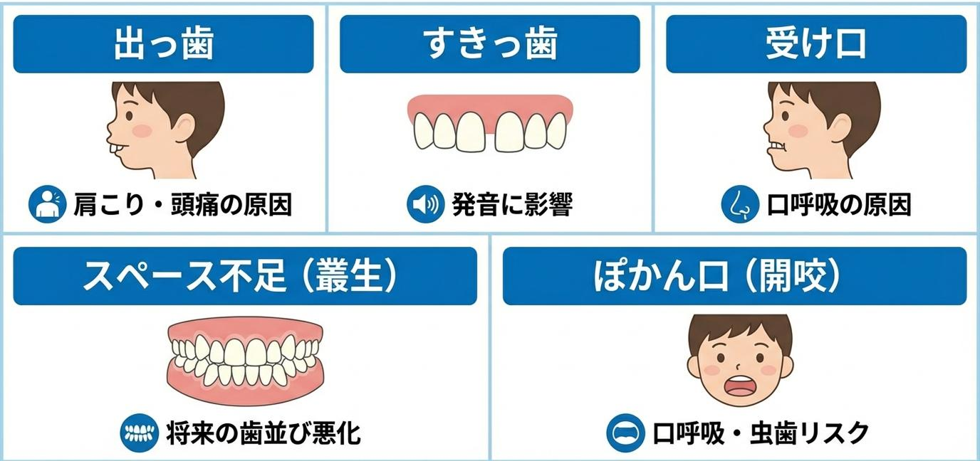 お子さんの歯並びのお悩み