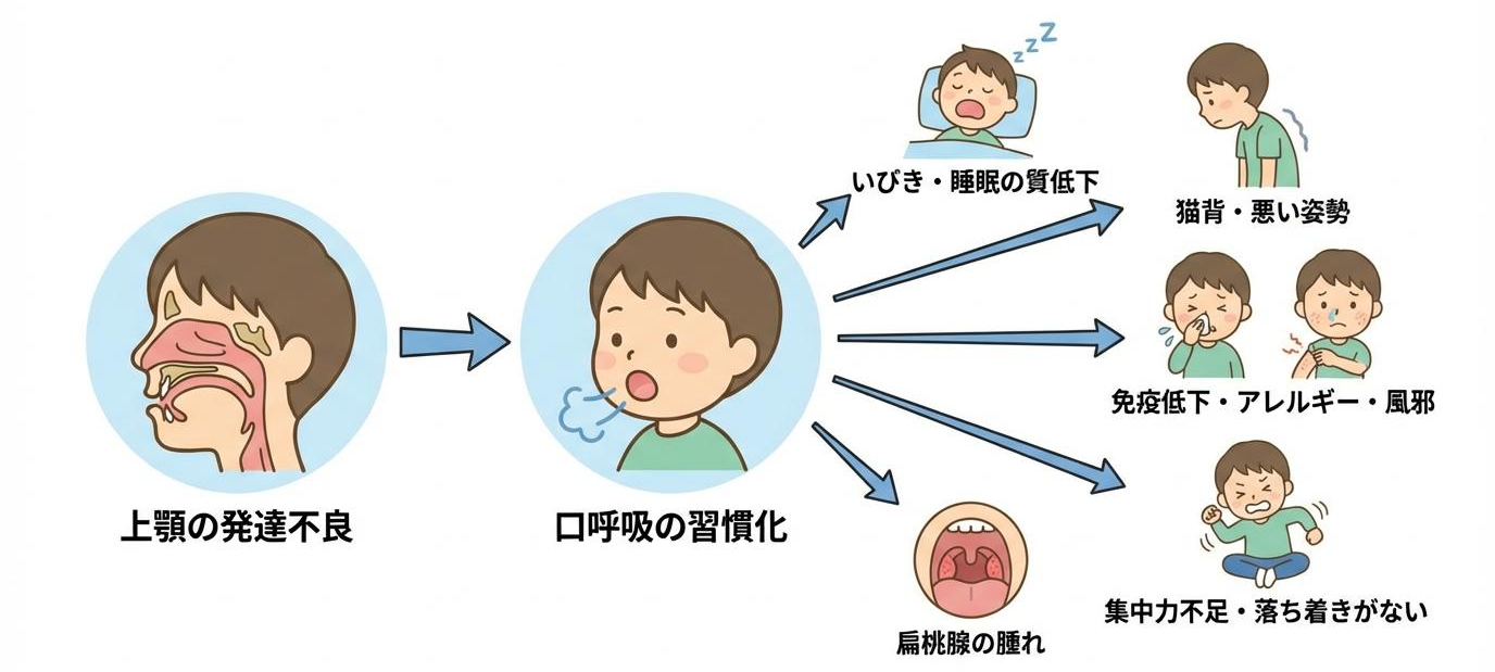上顎の発達不良から来ている可能性があります