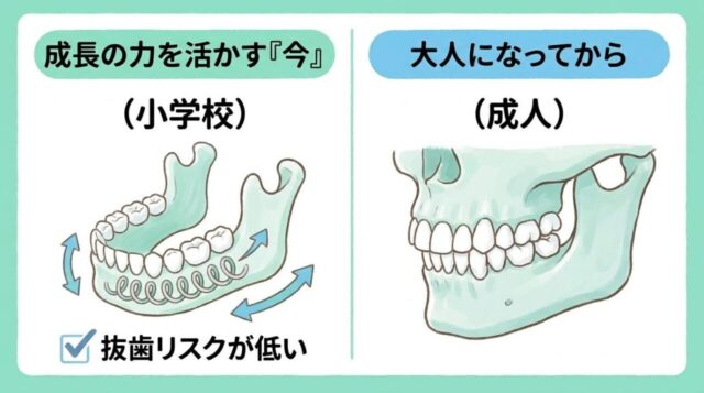 小学生の矯正治療、ベストなタイミングはいつ？