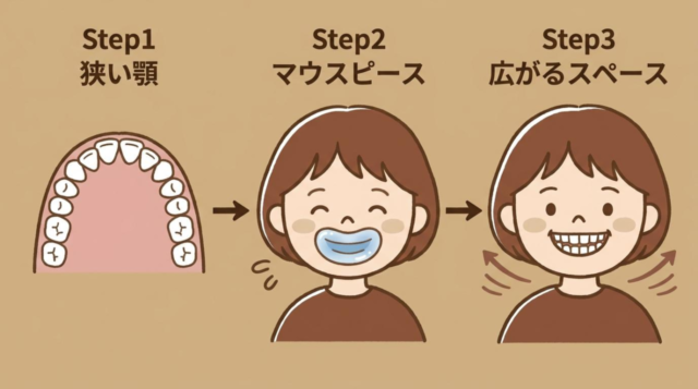 お口のトレーニング（MFT）とマウスピース型装置