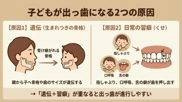 子どもが出っ歯になる原因【遺伝と習癖】